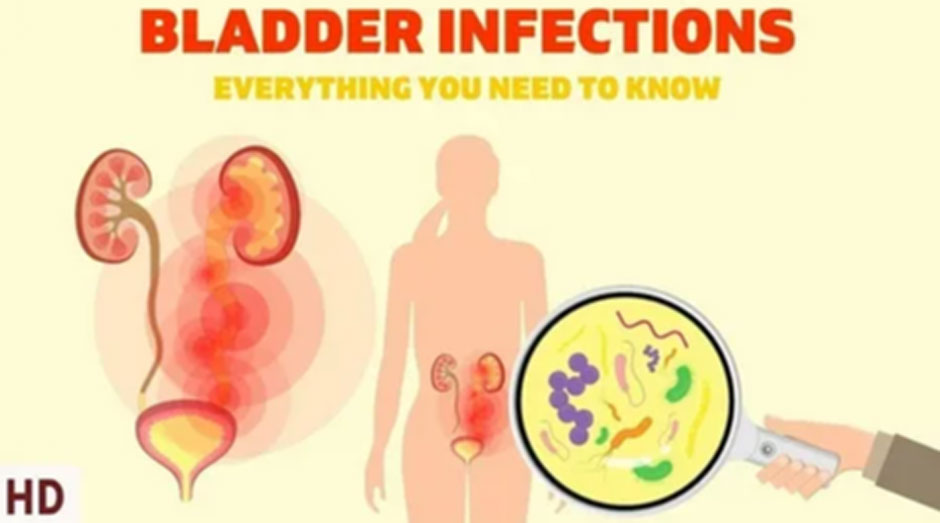 UTI Treatment St. John and the Microbiome-Drug Interaction Paradigm
