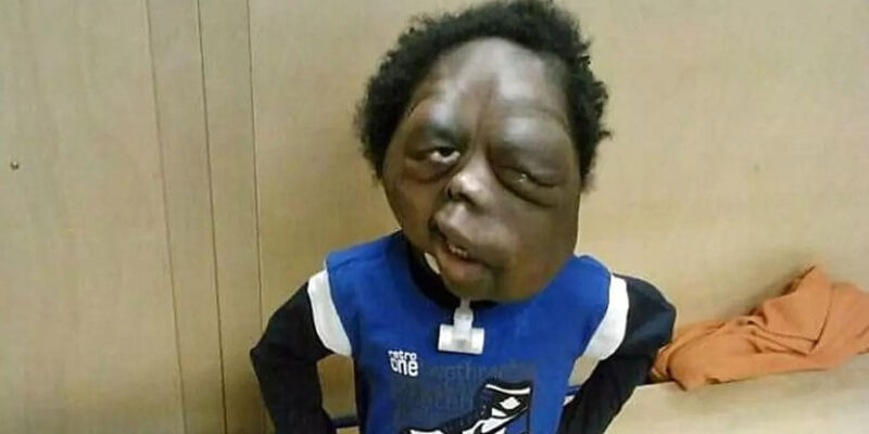 The Unyielding Spirit of Amare Stover: A Journey of Hope and Resilience