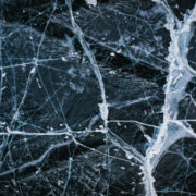 5 Modern Medicine Is Improving Life for People with Multiple Sclerosis