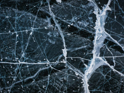 5 Modern Medicine Is Improving Life for People with Multiple Sclerosis